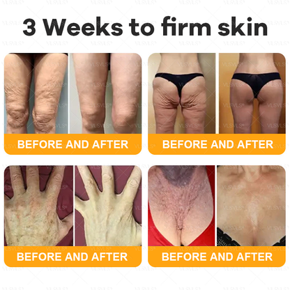 🌻VLSVLS® Bee Venom Comprehensive Cream  🇨🇦🇨🇦LAST DAY 80% OFF (Sagging Skin, Fine Lines, Loss of Firmness, Flat Bust, Drooping Hips, and More)