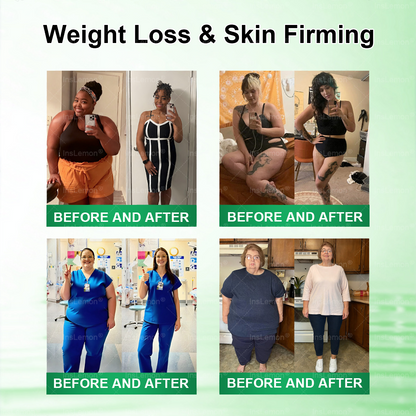 🔥𝐈𝐧𝐬𝐋𝐞𝐦𝐨𝐧® 𝗠𝗼𝗿𝗶𝗻𝗴𝗮 × 𝗕𝗲𝗿𝗯𝗲𝗿𝗶𝗻𝗲 × 𝗔𝗠𝗣𝗞 𝟭𝟬-𝗶𝗻-𝟭 𝗠𝗲𝘁𝗮𝗯𝗼𝗹𝗶𝗰 𝗦𝘂𝗽𝗽𝗼𝗿𝘁 𝗡𝗮𝗻𝗼 𝗠𝗶𝗰𝗿𝗼𝗻𝗲𝗲𝗱𝗹𝗲 𝗣𝗮𝘁𝗰𝗵🇨🇦(𝐉𝐮𝐬𝐭 𝐨𝐧𝐜𝐞 𝐚 𝐝𝐚𝐲, 𝐯𝐢𝐬𝐢𝐛𝐥𝐞 𝐜𝐡𝐚𝐧𝐠𝐞𝐬 𝐢𝐧 𝟕 𝐝𝐚𝐲𝐬） ✅ 𝐅𝐨𝐫 𝐨𝐛𝐞𝐬𝐢𝐭𝐲, 🅛🅞🅞🅢🅔 🅢🅚🅘🅝,𝐝𝐢𝐚𝐛𝐞𝐭𝐞𝐬, 𝐬𝐥𝐞𝐞𝐩 𝐚𝐩𝐧𝐞𝐚, 𝐣𝐨𝐢𝐧𝐭 𝐢𝐬𝐬𝐮𝐞𝐬, 𝐚𝐧𝐝 𝐦𝐨𝐫𝐞
