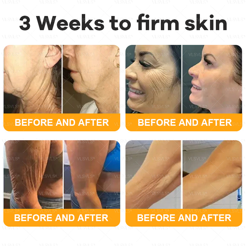 🌻VLSVLS® Bee Venom Comprehensive Cream  🇨🇦🇨🇦LAST DAY 80% OFF (Sagging Skin, Fine Lines, Loss of Firmness, Flat Bust, Drooping Hips, and More)